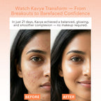 EOB 20% Vitamin C Serum with Hyaluronic Acid Face Serum | Grocsy