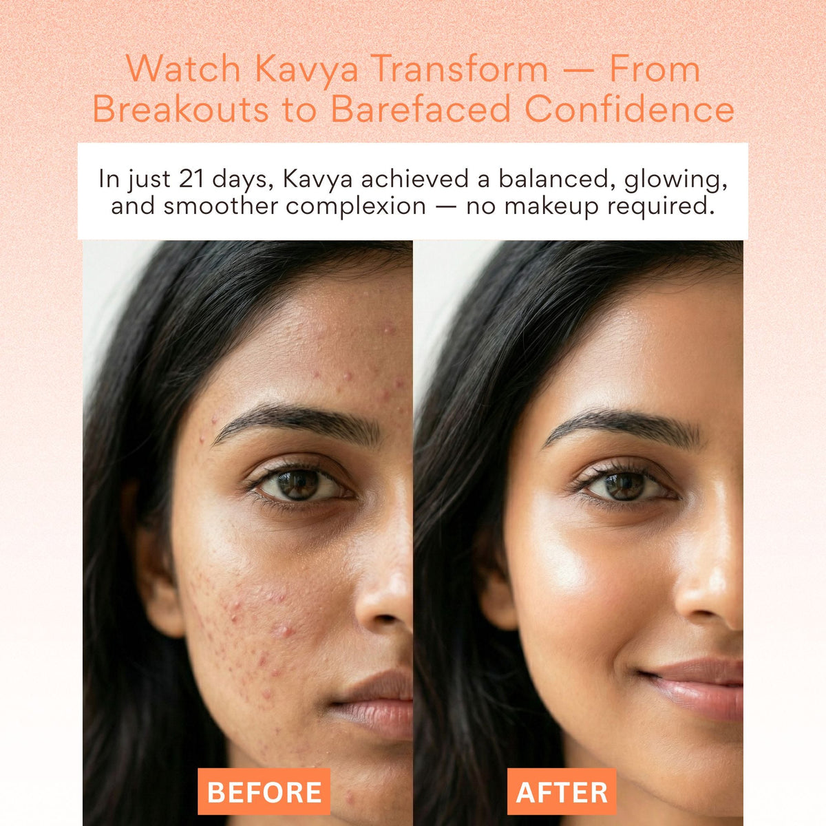EOB 20% Vitamin C Serum with Hyaluronic Acid Face Serum | Grocsy