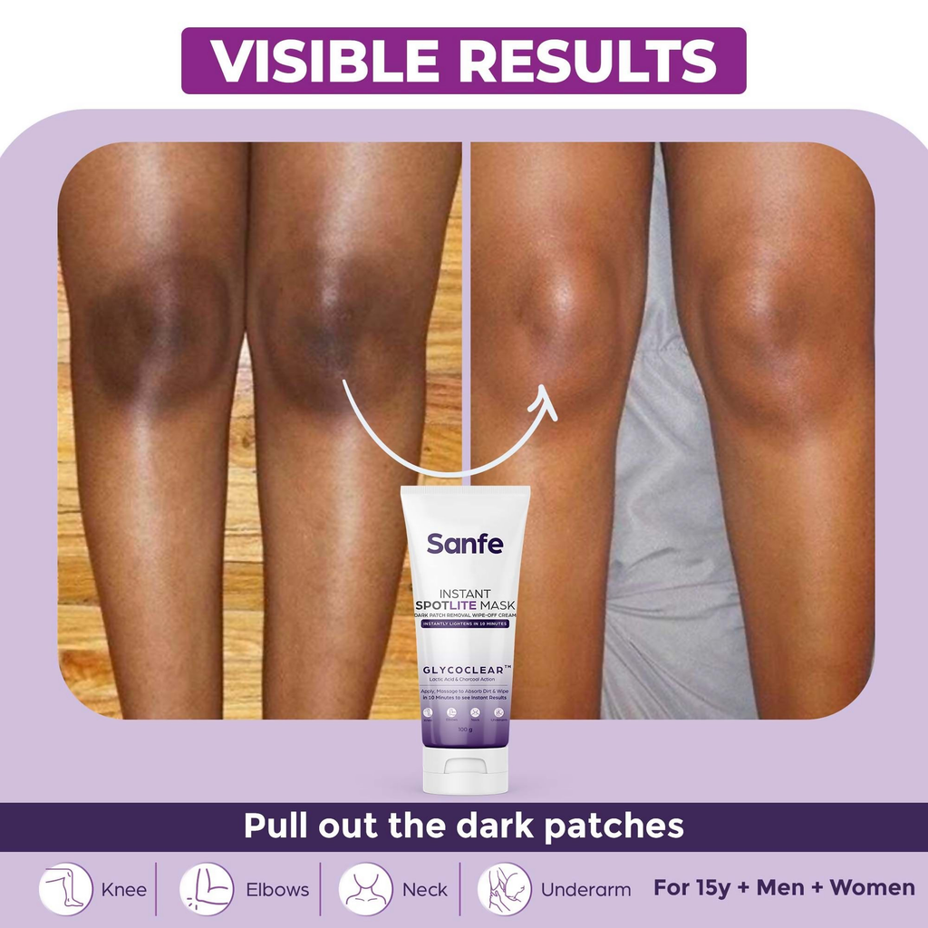 Sanfe Instant Spotlite Mask For Dark Underarm | Grocsy