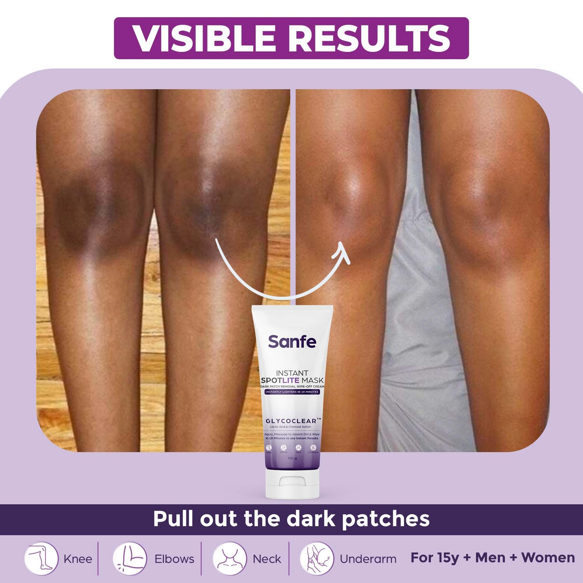 Sanfe Instant Spotlite Mask For Dark Underarm | Grocsy