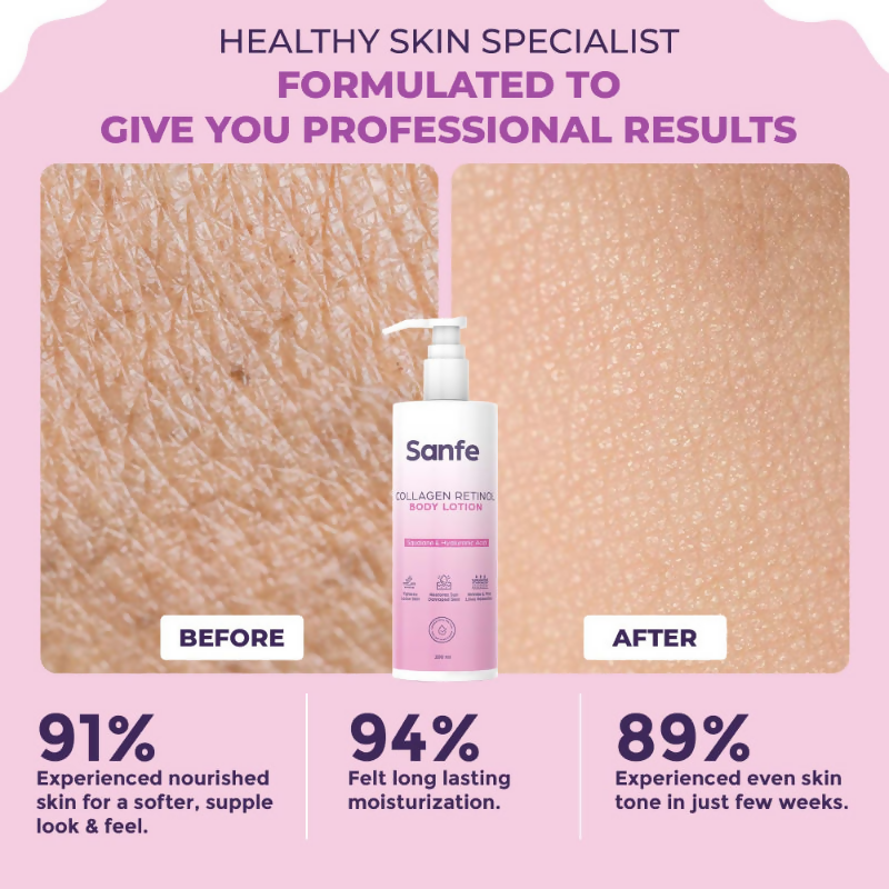Sanfe Collagen Retinol Body Lotion | Grocsy