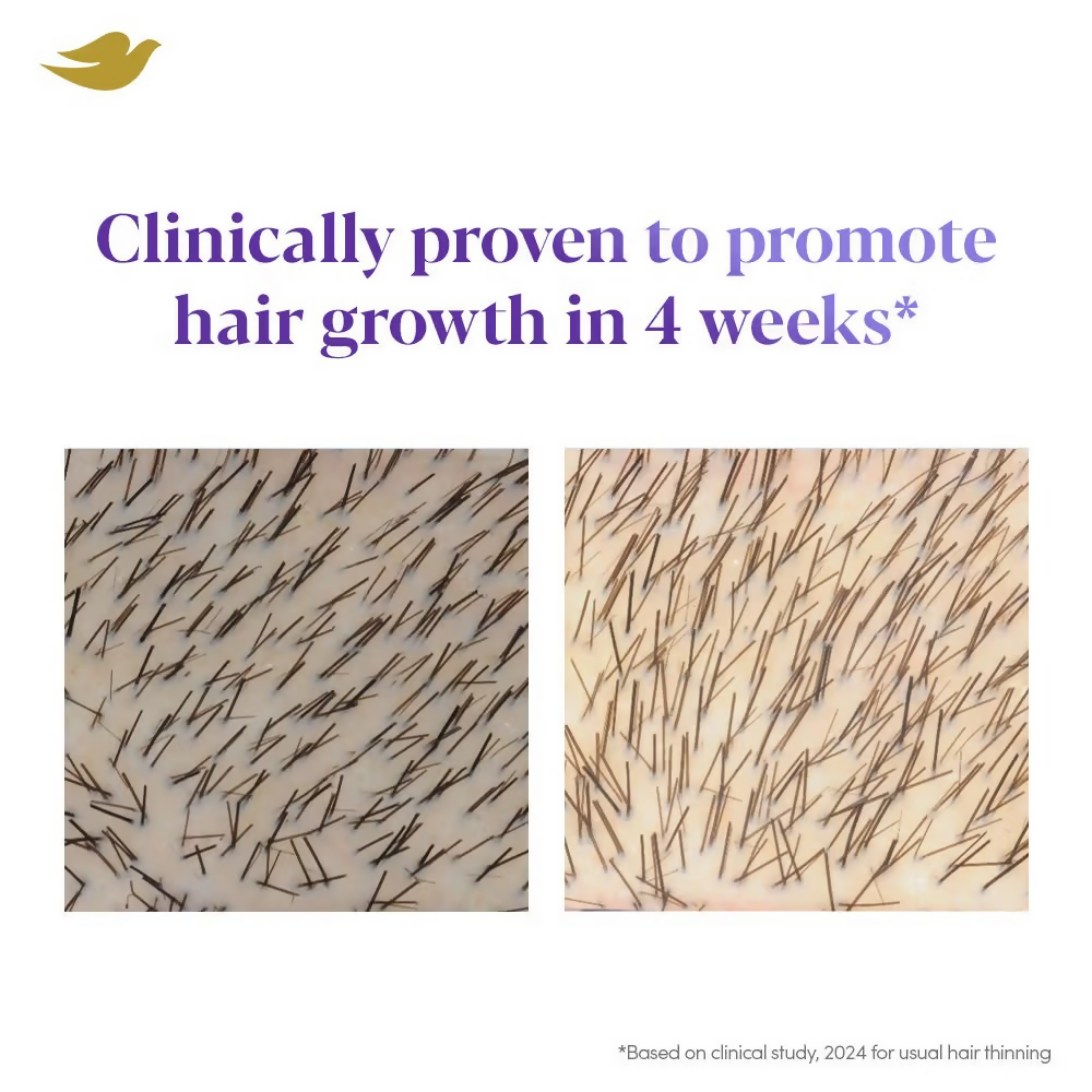 Dove Scalp + Hair Therapy Density Boost Revitalizing Scalp Night Serum | Grocsy