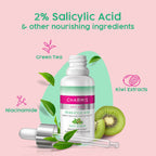 Charmis Anti Acne 2% Salicylic Acid Face Serum with Green Tea & Kiwi Extracts for Clear & Glowing Skin | Grocsy