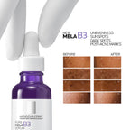 La Roche-Posay Mela B3 Serum, For Anti-Dark Spots & Pigmented Skin with Melasyl + 10% Niacinamide | Grocsy