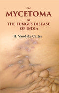 On Mycetoma or the Fungus Disease of India - Gyan Books | Grocsy