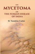 On Mycetoma or the Fungus Disease of India - Gyan Books | Grocsy