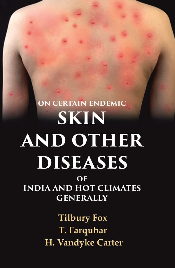 On Certain Endemic Skin and Other Diseases of India and Hot Climates Generally - Gyan Books | Grocsy