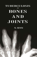 Tuberculosis of Bones and Joints - Gyan Books | Grocsy