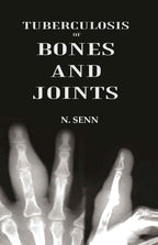 Tuberculosis of Bones and Joints - Gyan Books | Grocsy