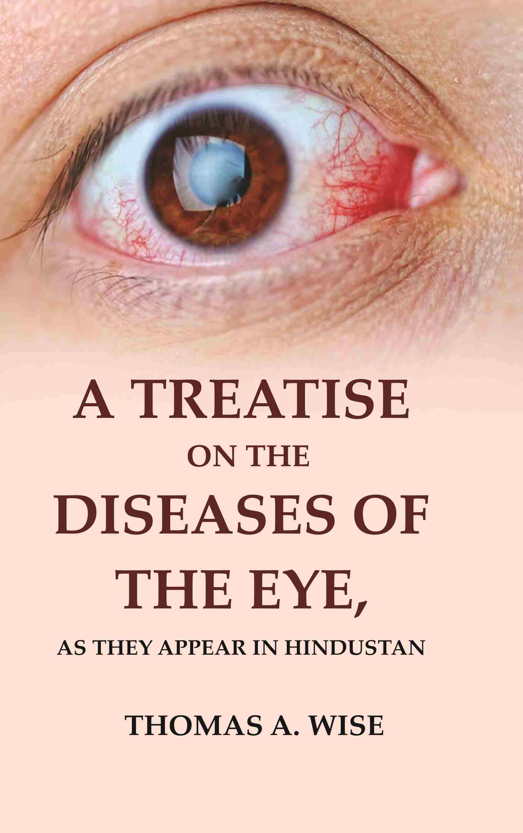 A Treatise on the Diseases of The Eye: As they appear in Hindustan - Gyan Books | Grocsy