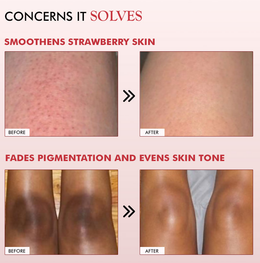 mCaffeine 11% AHA-BHA Skin Smoothening Strawberry Body Lotion | Grocsy