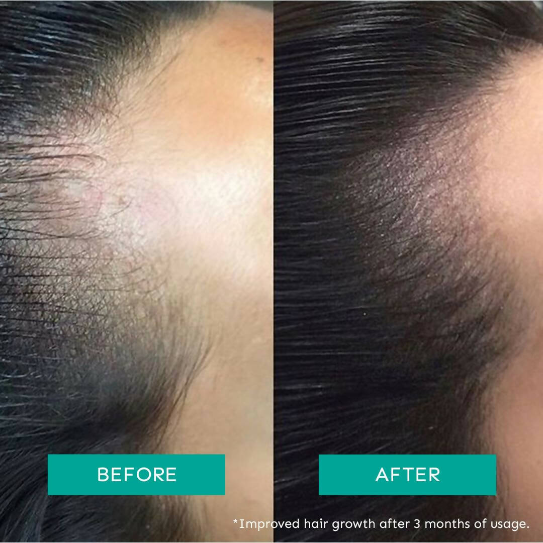 Arata Intensive Hair Growth Serum | Grocsy