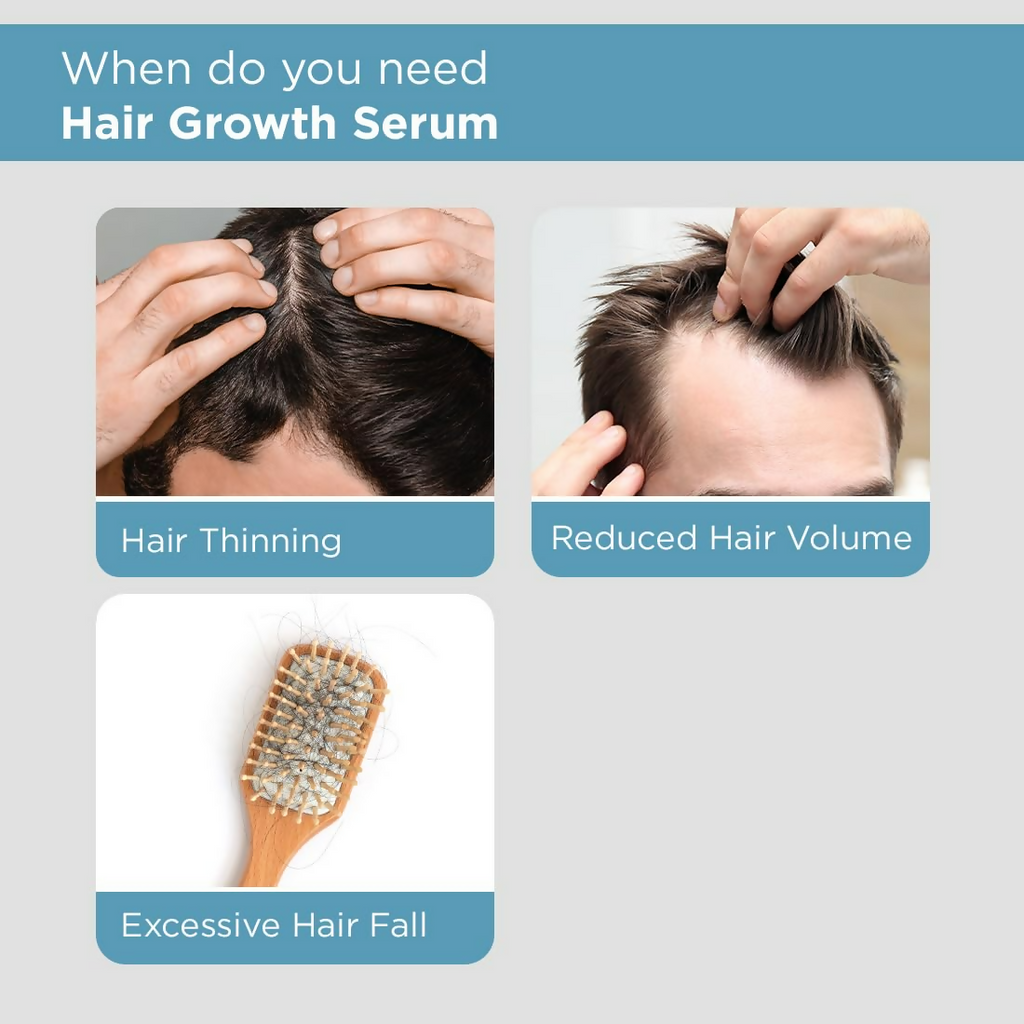 The Man Company Hair Growth Serum For Man | Grocsy
