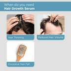The Man Company Hair Growth Serum For Man | Grocsy