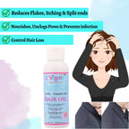 Vigini Anti Dandruff Itchy Scalp Hair Care Oil for Men Women Anti Hair Fall | Grocsy