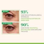 Murad Retinol Youth Renewal Eye Serum | Grocsy
