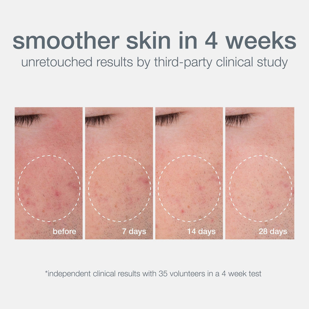 Dermalogica Daily Microfoliant Face Scrub | Grocsy