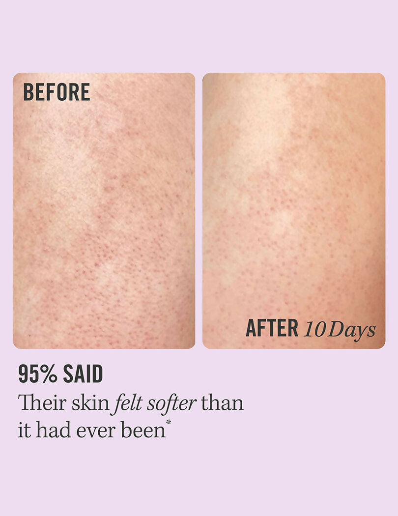 First Aid Beauty KP Bump Eraser Body Scrub | Grocsy