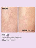 First Aid Beauty KP Bump Eraser Body Scrub | Grocsy