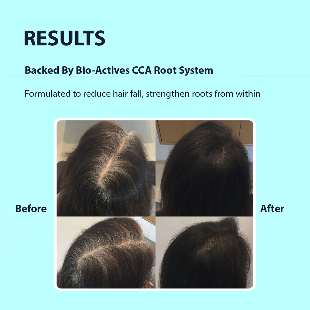 Dermistry Follicusan Hairgenyl & Caffeine Anti Hair Fall Control Serum Mask & Shampoo | Grocsy