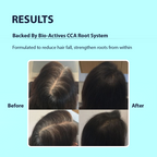 Dermistry Follicusan Hairgenyl & Caffeine Anti Hair Fall Control Serum Mask & Shampoo | Grocsy
