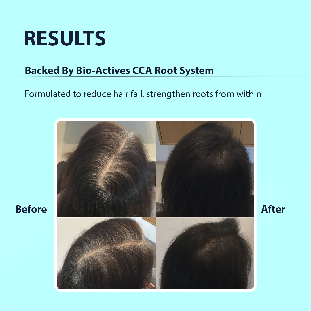 Dermistry Follicusan Hairgenyl & Caffeine Anti Hair Fall Control Serum Mask & Shampoo | Grocsy