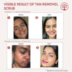 Ivory Natural Tan Scrub , Reduce Tan, Restores Radiant Skin Glow | Grocsy