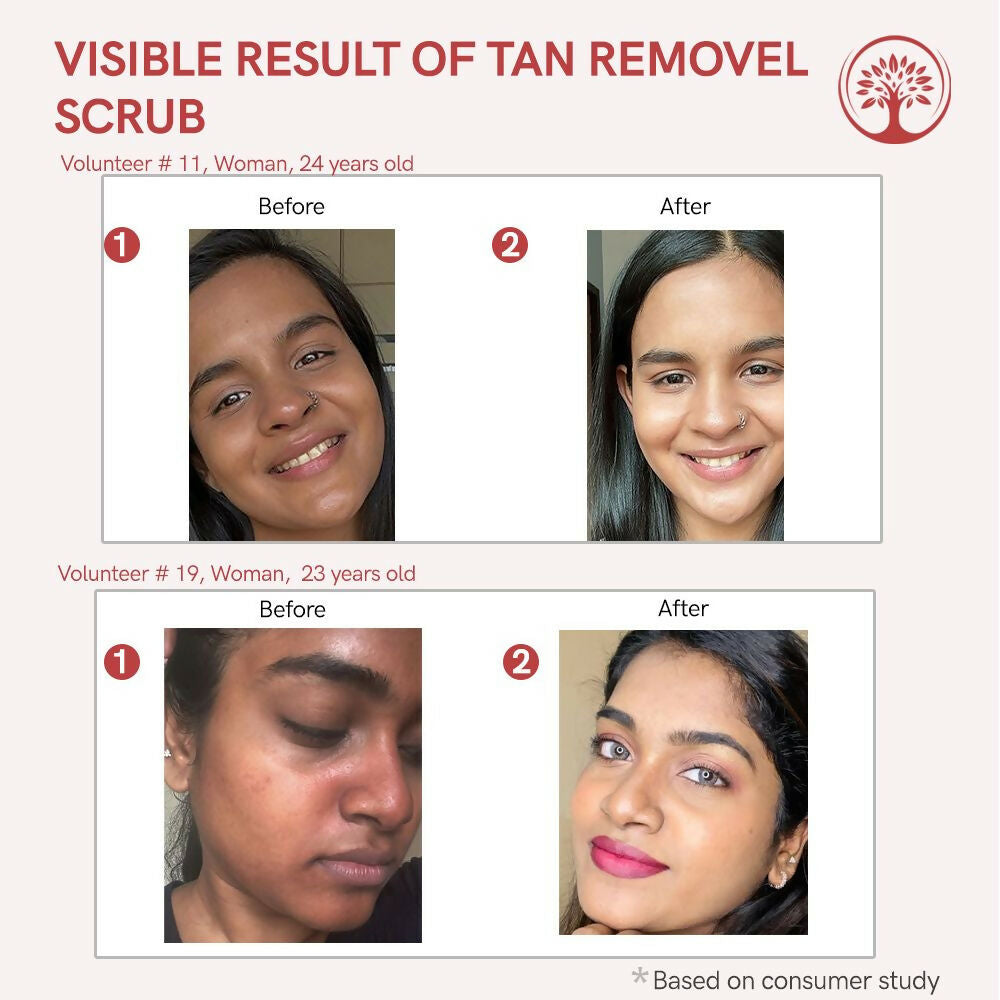 Ivory Natural Tan Scrub , Reduce Tan, Restores Radiant Skin Glow | Grocsy