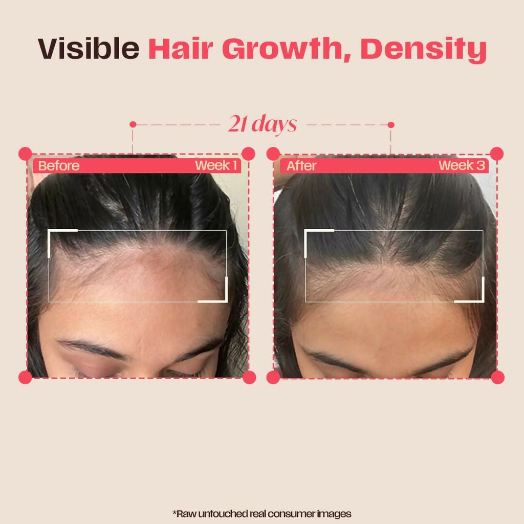 Days Ahead Leave-in Hair Growth Ampoule Serum (Roll on) | Grocsy