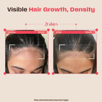 Days Ahead Leave-in Hair Growth Ampoule Serum (Roll on) | Grocsy