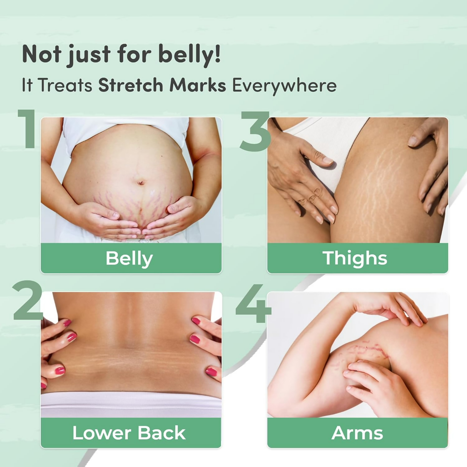 Mylo Care Stretch Marks Combo | Grocsy