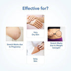 The Moms Co Natural Stretch Oil | Grocsy