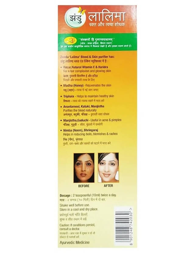Zandu Lalima Blood And Skin Purifier Syrup | Grocsy