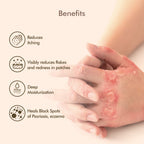 VedicDerm Oleander's Oil for Psoriasis, Eczema, and Atopic Dermatitis | Grocsy