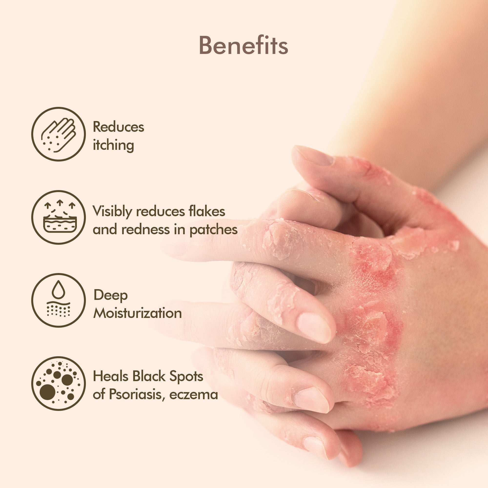 VedicDerm Oleander's Oil for Psoriasis, Eczema, and Atopic Dermatitis | Grocsy
