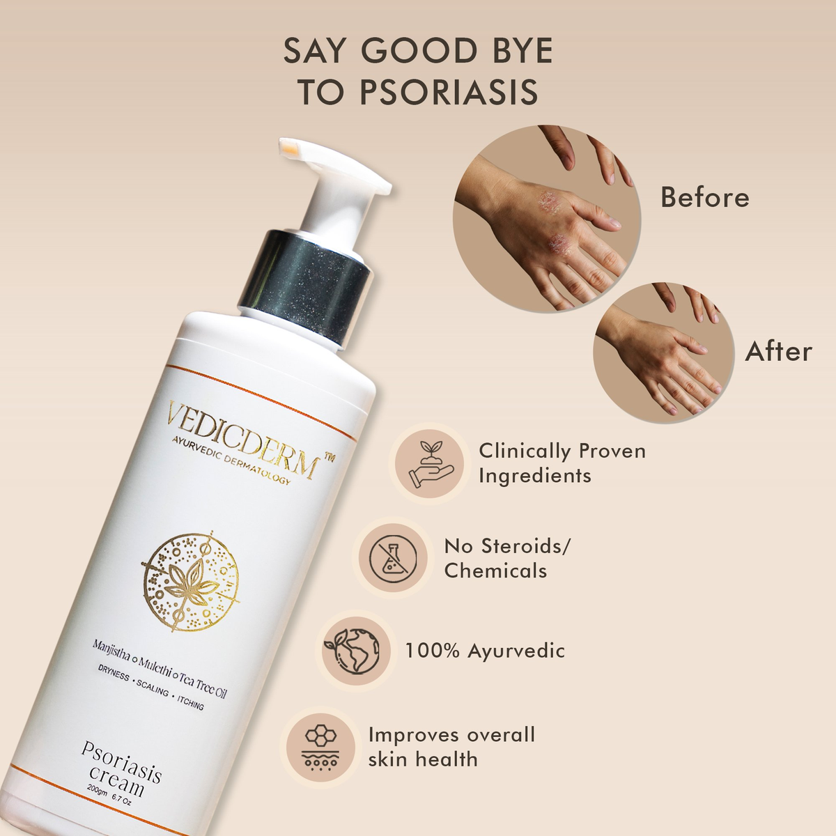 Vedicderm Psoriasis Cream with 2% Bakuchi Extract | Grocsy