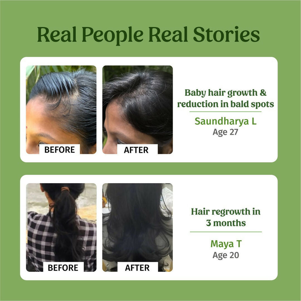 Vilvah Store Hair Growth Oil (Baby Hair Growth) | Grocsy