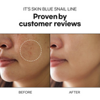 It's Skin Blue Snail Serum | Grocsy