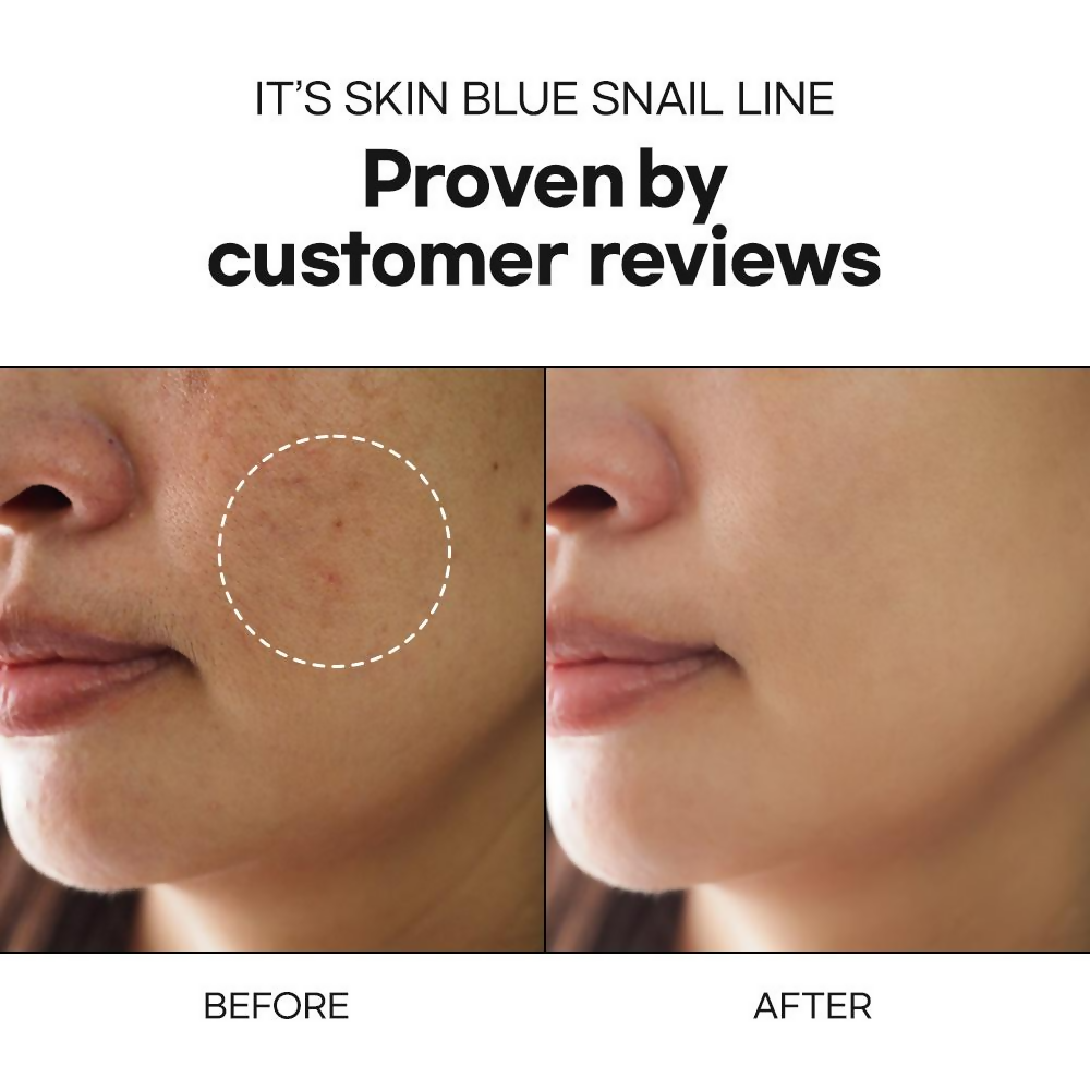 It's Skin Blue Snail Serum | Grocsy
