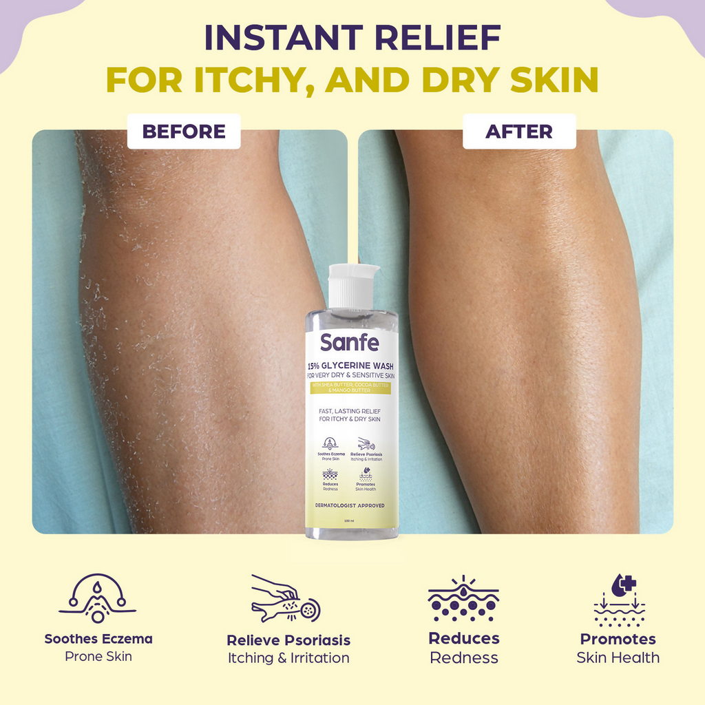 Sanfe Eczema Relief Wash For Very Very Dry Skin | Grocsy