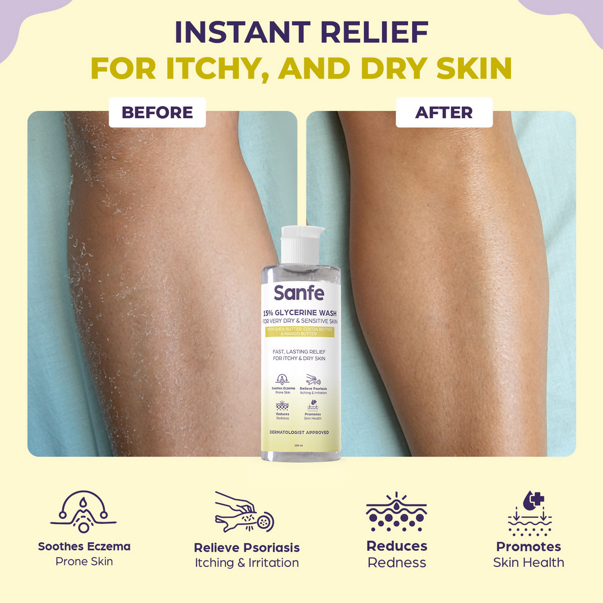 Sanfe Eczema Relief Wash For Very Very Dry Skin | Grocsy