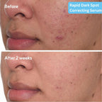 SkinLuv Dark Spot Correcting Serum | Grocsy