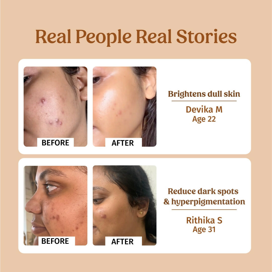 Vilvah Store Milk Drops Brightening Serum (Skin Brightening) | Grocsy