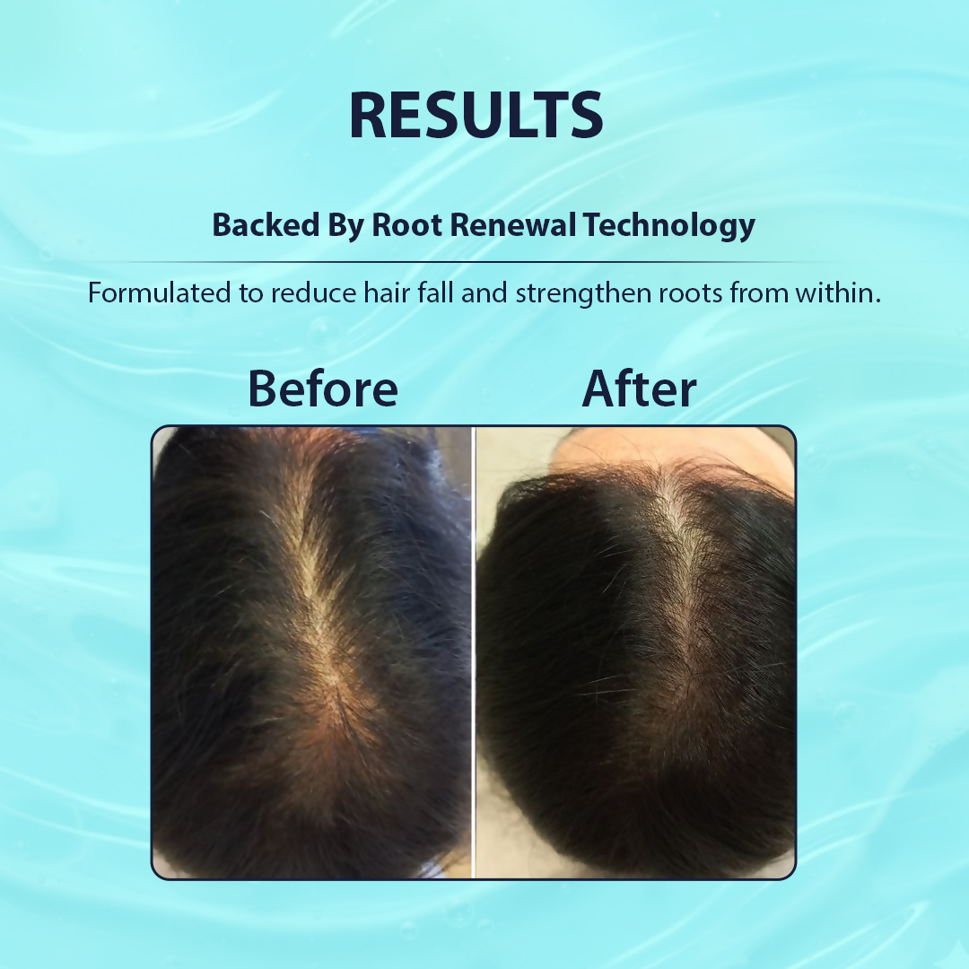 Dermistry Follicusan Hairgenyl & Caffeine Anti Hair Fall Control Serum & Shampoo | Grocsy