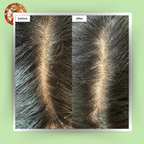 Botanical Luxuriate Tea Tree Natural Anti Lice and Nits Shampoo | Grocsy
