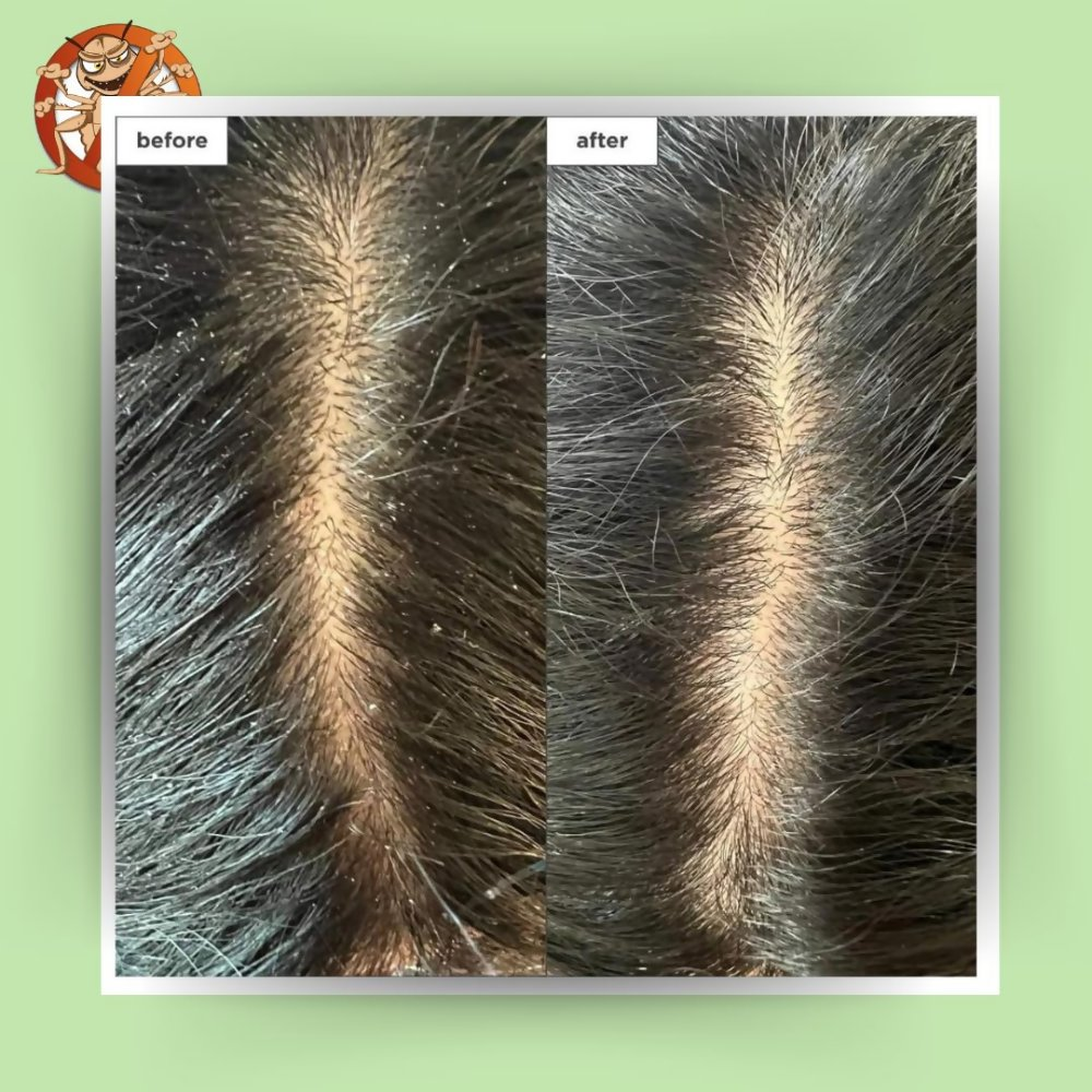 Botanical Luxuriate Tea Tree Natural Anti Lice and Nits Shampoo | Grocsy