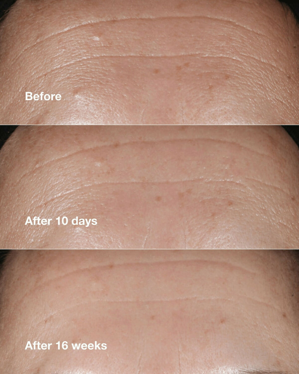 Clinique Smart Clinical Repair Wrinkle Correcting Serum | Grocsy
