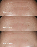 Clinique Smart Clinical Repair Wrinkle Correcting Serum | Grocsy