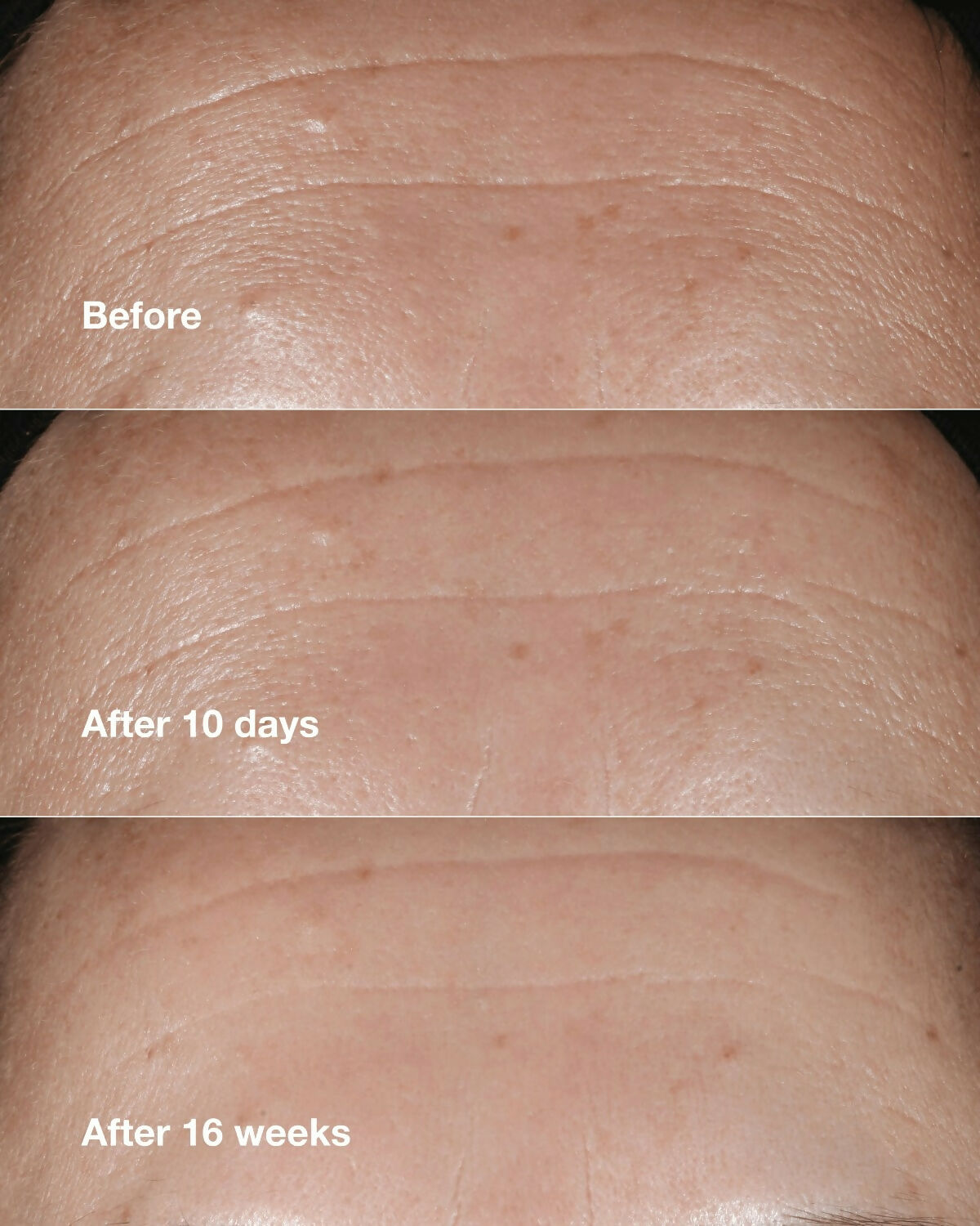 Clinique Smart Clinical Repair Wrinkle Correcting Serum | Grocsy