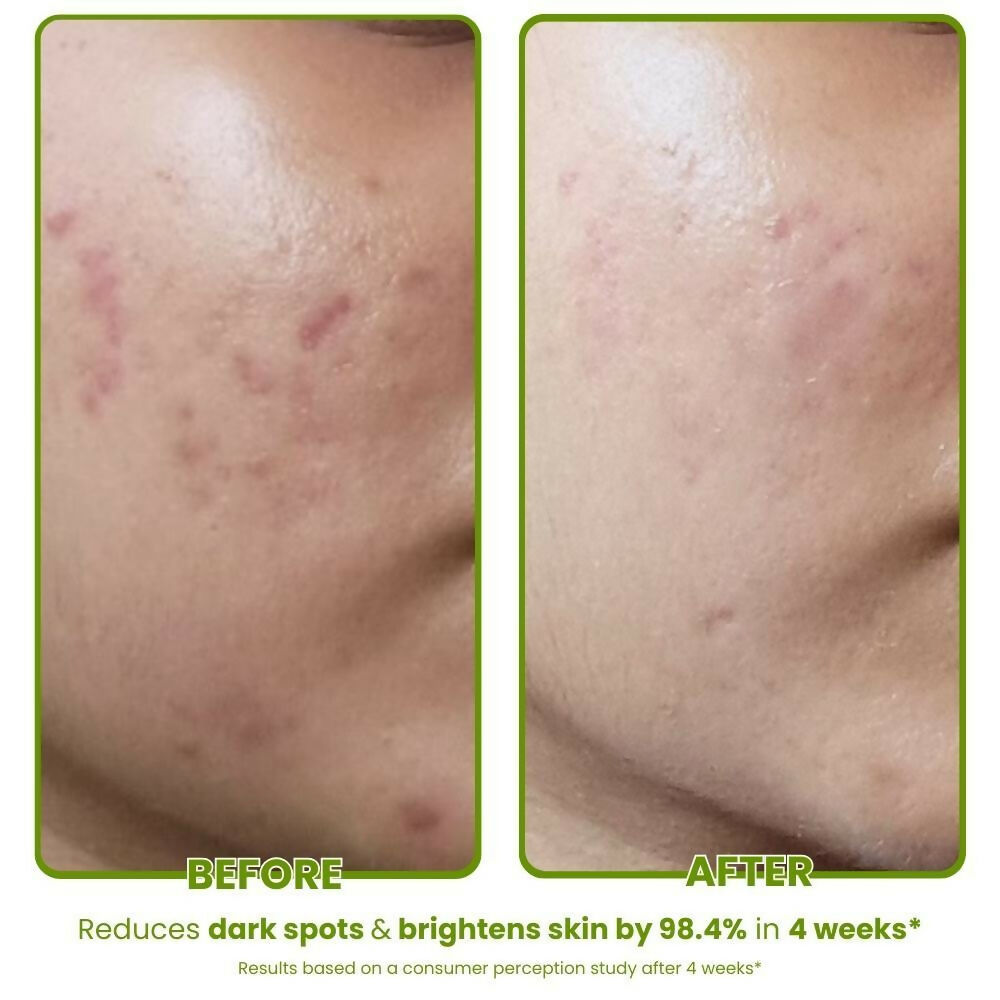 The Skin Diet Avocado Milky Glow Serum for Even Skin Tone with Hyaluronic Acid for Dull Skin | Grocsy
